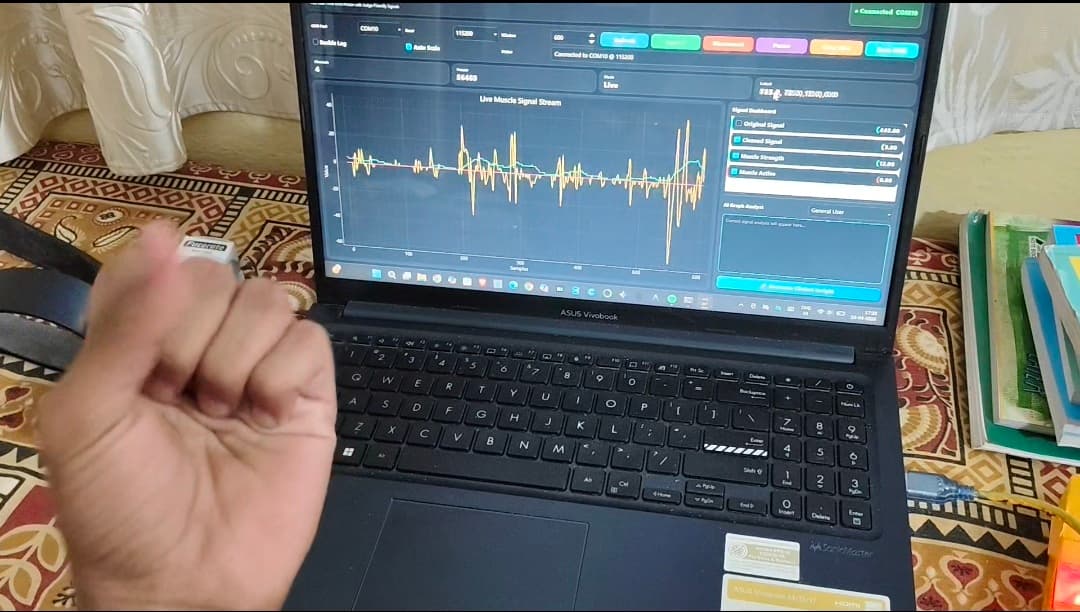 NeuroPulseAI live EMG plotting software displaying muscle activity